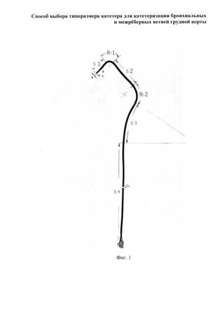 Способ выбора типоразмера катетера для катетеризации бронхиальных и межрёберных ветвей грудной аорты (патент 2661096)
