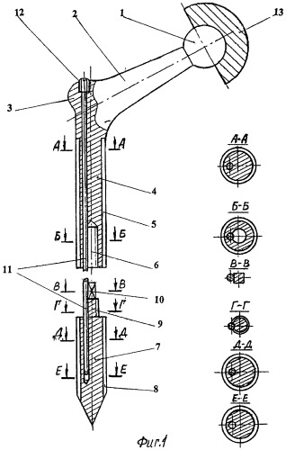 Эндопротез тазобедренного сустава и устройство для его установки (патент 2309706)