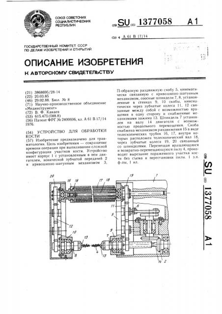 Устройство для обработки кости (патент 1377058)