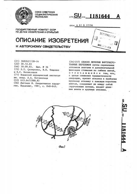 Способ лечения внутрисуставных переломов (патент 1181644)