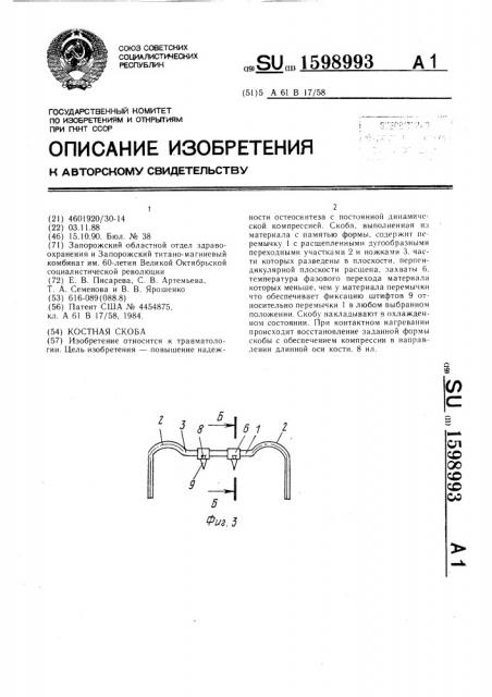 Костная скоба (патент 1598993)