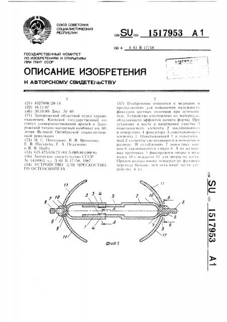 Устройство для чрескостного остеосинтеза (патент 1517953)