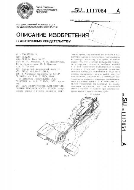 Устройство для определения подвижности зубов (патент 1117054)