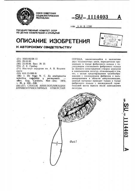 Способ аннулопликации атривентрикулярных отверстий сердца (патент 1114403)