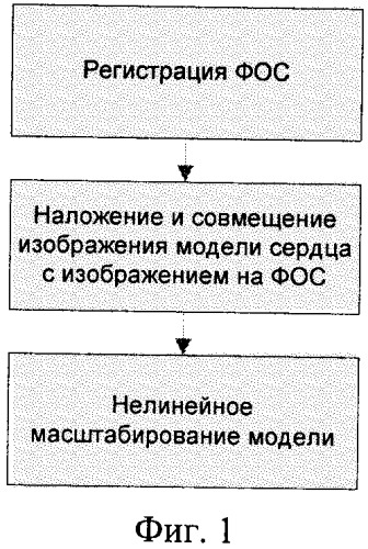 Способ автоматического определения размеров и положения сердца пациента по флюорографическим снимкам (патент 2372844)