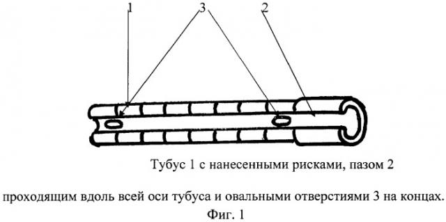 Устройство для проведения в мочевой пузырь фиксирующихся уретральных катетеров при троакарной цистостомии (патент 2408311)