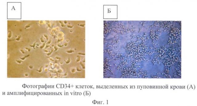 Способ экспансии cd34+ гематопоэтических клеток (патент 2469086)