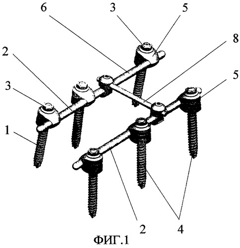 Спинальное устройство, преимущественно для соединительных штанг (патент 2301040)