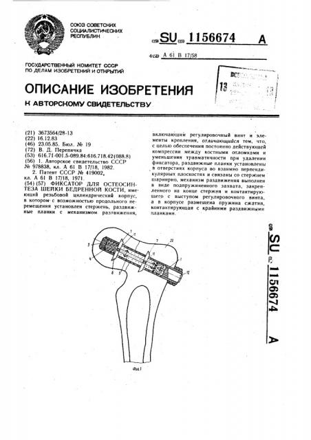 Фиксатор для остеосинтеза шейки бедренной кости (патент 1156674)