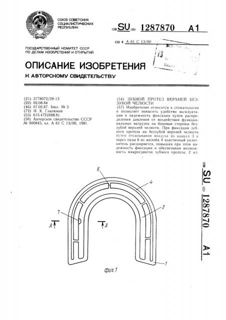 Зубной протез верхней беззубой челюсти (патент 1287870)