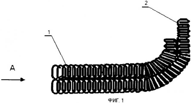 Композитный эндопротез для реконструкции дефектов нижней челюсти (патент 2365357)