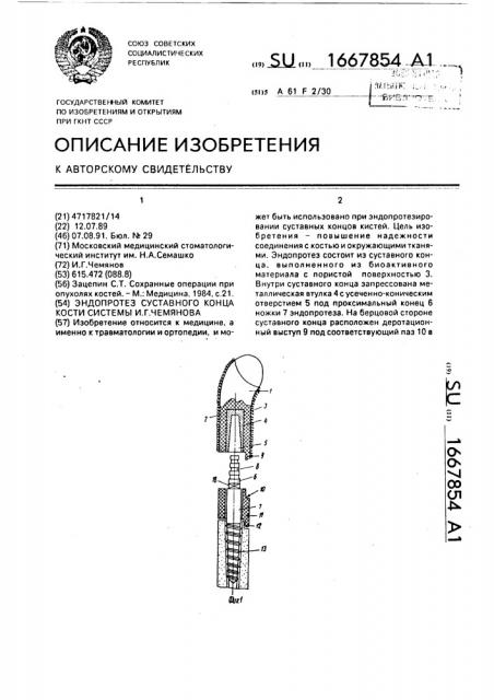 Эндопротез суставного конца кости системы и.г.чемянова (патент 1667854)