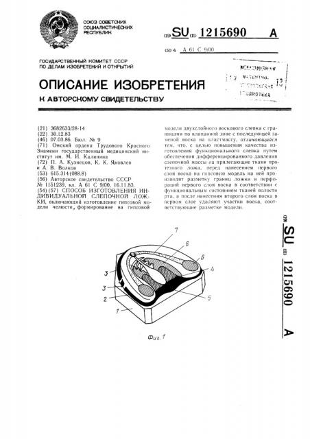 Способ изготовления индивидуальной слепочной ложки (патент 1215690)