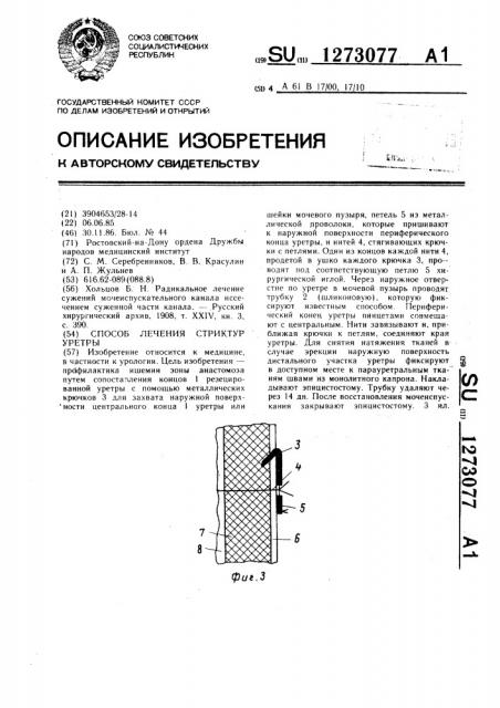 Способ лечения стриктур уретры (патент 1273077)