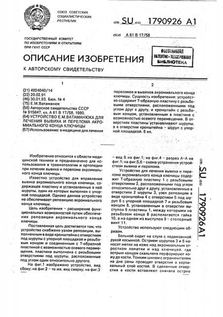 Устройство е.м.ватаманюка для лечения вывиха и перелома акромиального конца ключицы (патент 1790926)