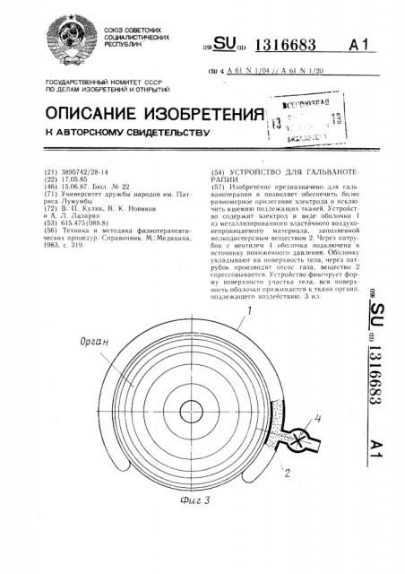Устройство для гальванотерапии (патент 1316683)