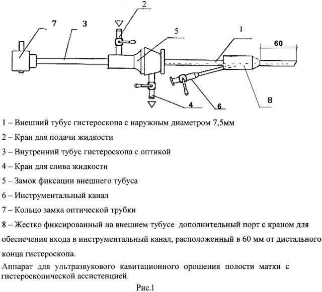 Аппарат для ультразвукового кавитационного орошения полости матки с гистероскопической ассистенцией (патент 2606495)