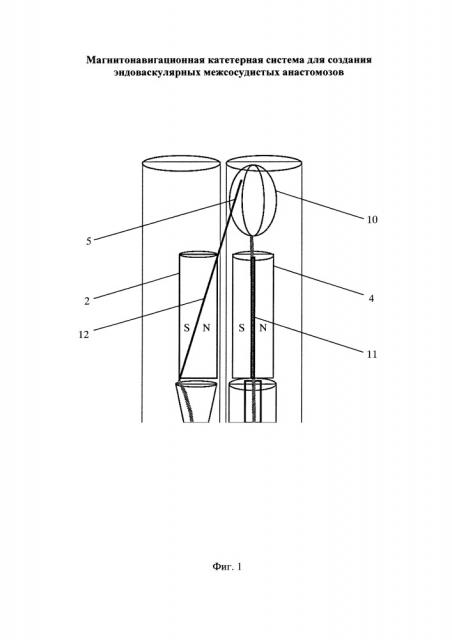 Магнитонавигационная катетерная система для создания эндоваскулярных межсосудистых анастомозов (патент 2662414)