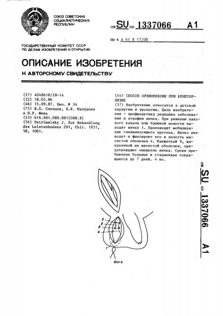 Способ орхиопексии при крипторхизме (патент 1337066)