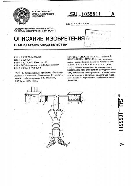 Способ искусственной вентиляции легких (патент 1055511)