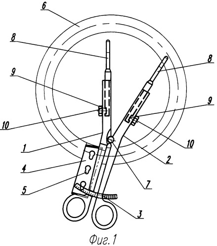 Ранорасширитель (патент 2313295)