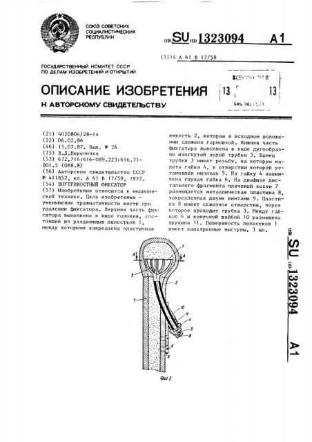 Внутрикостный фиксатор (патент 1323094)