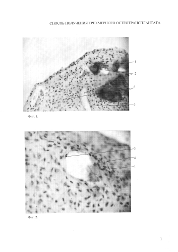 Способ получения трехмерного остеотрансплантата (патент 2574942)