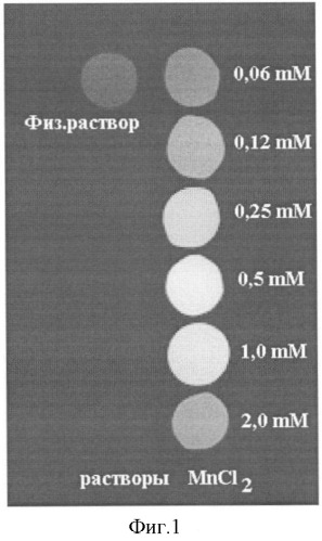 Способ магнитно-резонансной томографической диагностики ишемических нарушений коронарного кровообращения (патент 2330609)