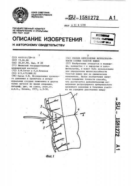 Способ определения жизнеспособности стенки толстой кишки (патент 1581272)