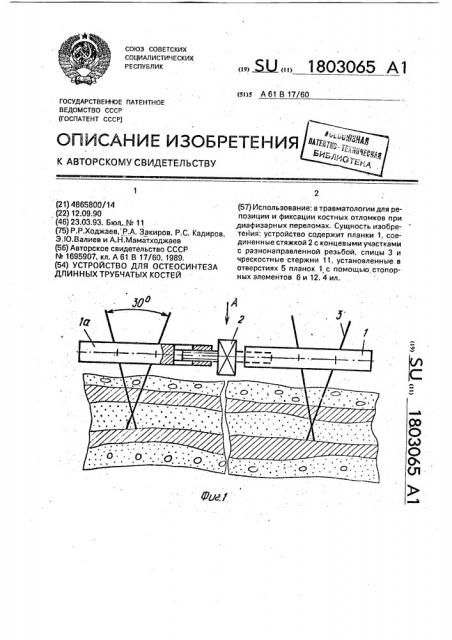 Устройство для остеосинтеза длинных трубчатых костей (патент 1803065)