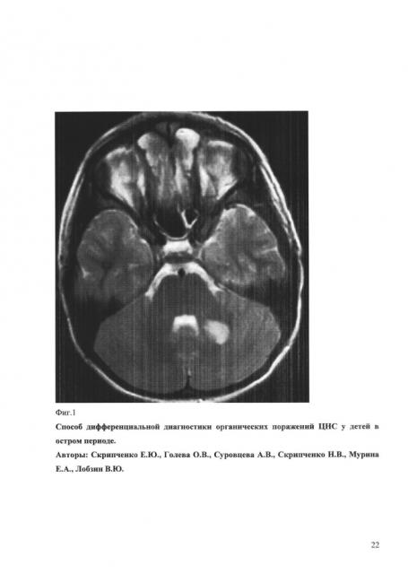 Способ дифференциальной диагностики органических поражений цнс у детей в остром периоде (патент 2648215)
