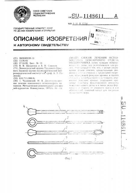 Способ лечения остеохондроза поясничного отдела позвоночника (патент 1148611)