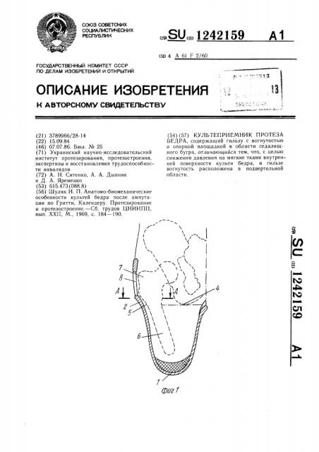 Культеприемник протеза бедра (патент 1242159)