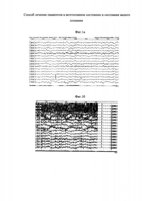 Способ лечения пациентов в вегетативном состоянии и состоянии малого сознания (патент 2612264)