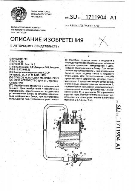 Способ установки медицинских банок и устройство для его осуществления (патент 1711904)