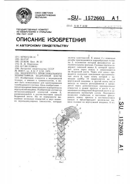 Эндопротез проксимального эпиметафиза бедренной кости (патент 1572603)