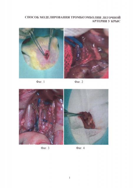 Способ моделирования тромбоэмболии легочной артерии у крыс (патент 2610212)