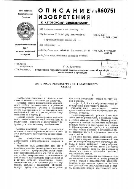 Способ реконструкции филатовского стебля (патент 860751)