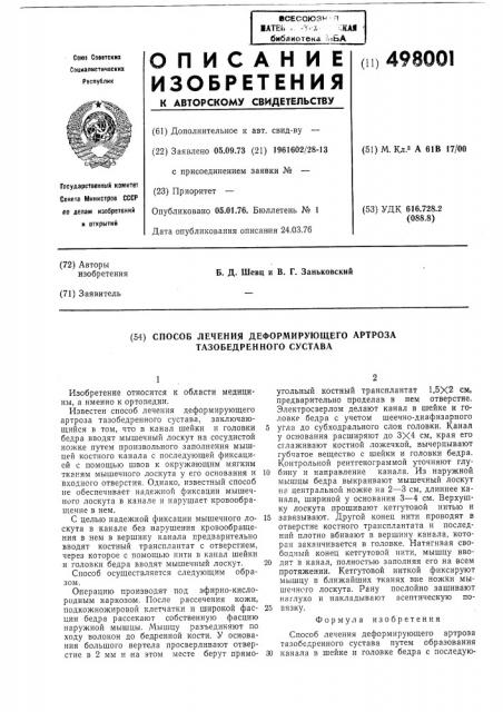 Способ лечения деформирующего артроза тазобедренного сустава (патент 498001)