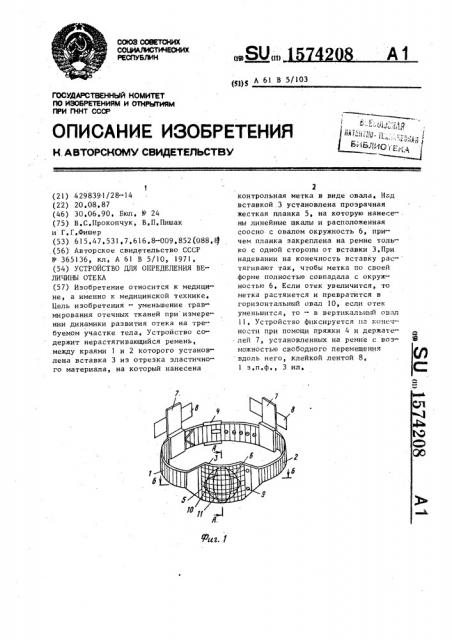 Устройство для определения величины отека (патент 1574208)