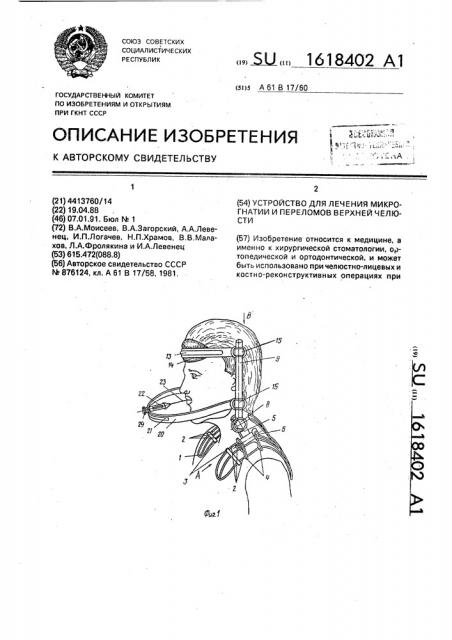 Устройство для лечения микрогнатии и переломов верхней челюсти (патент 1618402)