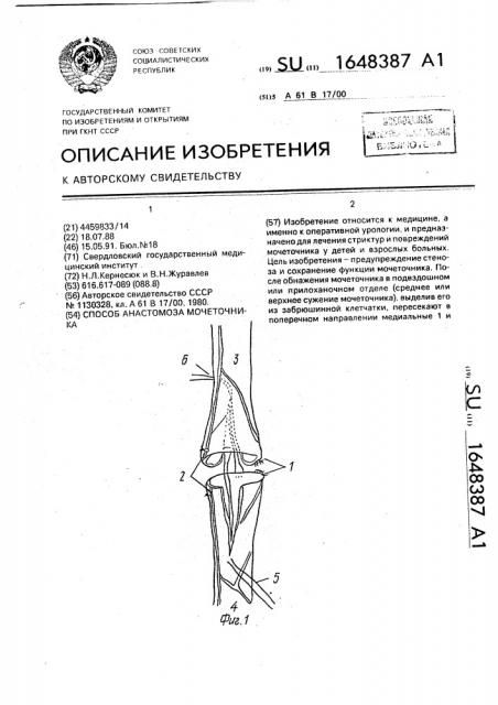 Способ анастомоза мочеточника (патент 1648387)