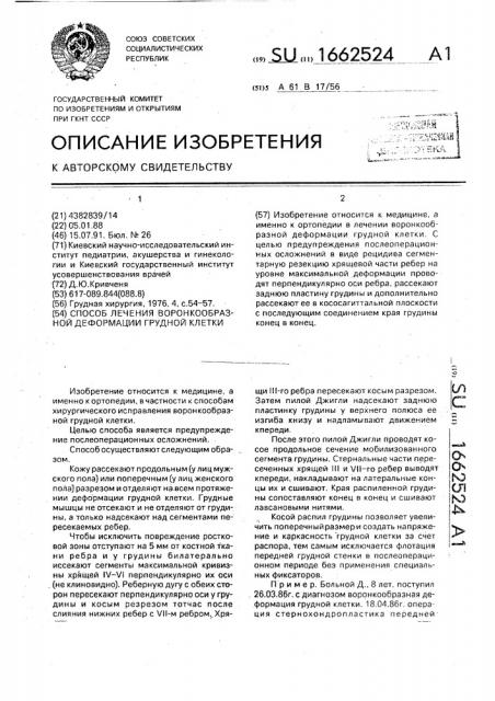 Способ лечения воронкообразной деформации грудной клетки (патент 1662524)