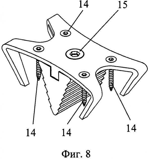 Комбинированный имплантат и инструменты для его установки (патент 2621949)