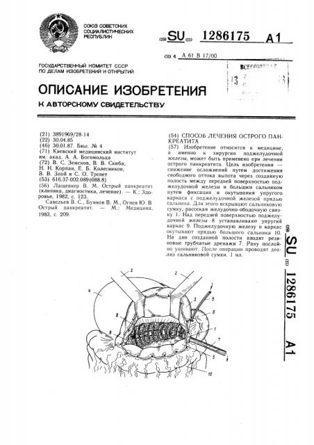 Способ лечения острого панкреатита (патент 1286175)