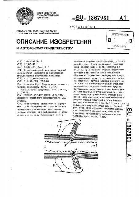 Способ формирования инвагинационного концевого межкишечного анастомоза (патент 1367951)