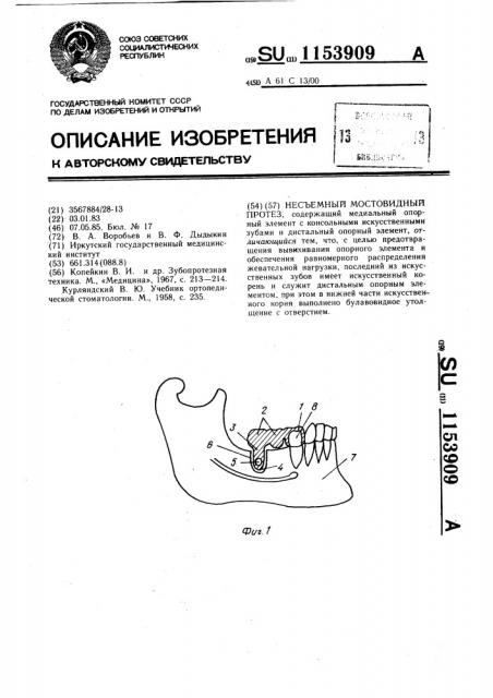 Несъемный мостовидный протез (патент 1153909)