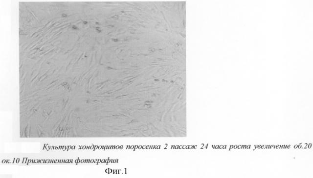 Способ получения донорских хондробластов (патент 2285039)