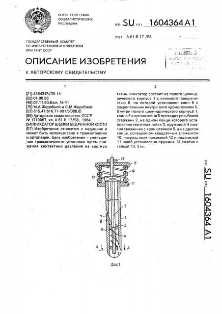 Фиксатор шейки бедренной кости (патент 1604364)