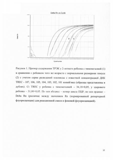 Способ диагностики тимомегалии у детей (патент 2611393)